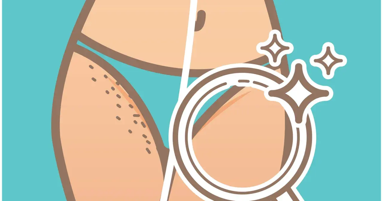 Przed i po depilacji bikini. Po lewej widoczne włoski, po prawej gładka skóra pod lupą, lśniąca.