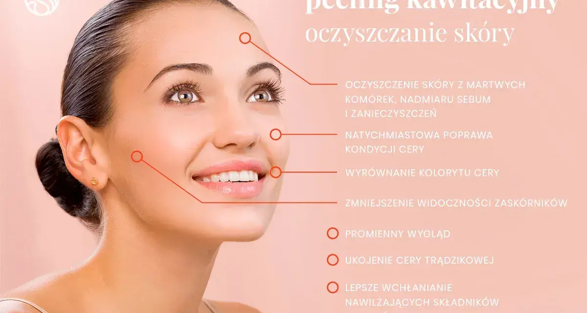 Uśmiechnięta kobieta z gładką cerą, której peeling kawitacyjny zapewnia głębokie oczyszczanie porów, redukcję zaskórników i promienny wygląd.