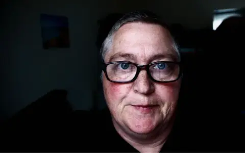 Mężczyzna z niebieskimi oczami i okularami. Jego **czerwona twarz** emanuje ciepłem, a na policzkach widać rumieńce.