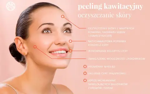 Uśmiechnięta kobieta z gładką cerą, której peeling kawitacyjny zapewnia głębokie oczyszczanie porów, redukcję zaskórników i promienny wygląd.