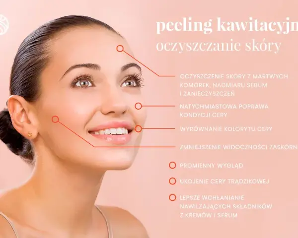 Uśmiechnięta kobieta z gładką cerą, której peeling kawitacyjny zapewnia głębokie oczyszczanie porów, redukcję zaskórników i promienny wygląd.