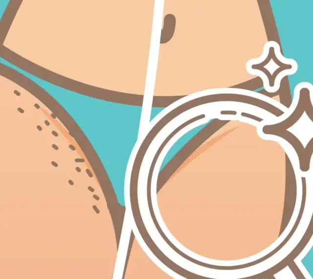Przed i po depilacji bikini. Po lewej widoczne włoski, po prawej gładka skóra pod lupą, lśniąca.